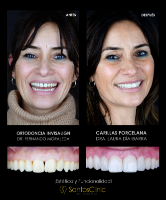 DISE�O DE SONRISAS